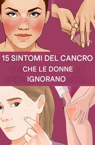 15 primi segnali di crescita del cancro nel corpo