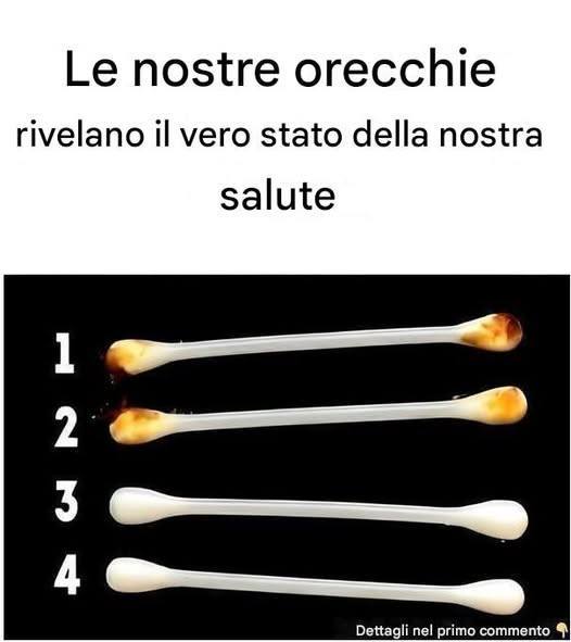ADVERTISEMENT   Le nostre orecchie rivelano il vero stato della nostra salute