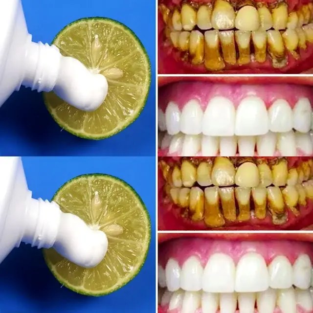 Illumina il tuo sorriso in modo naturale: il metodo sbiancante al limone in due minuti