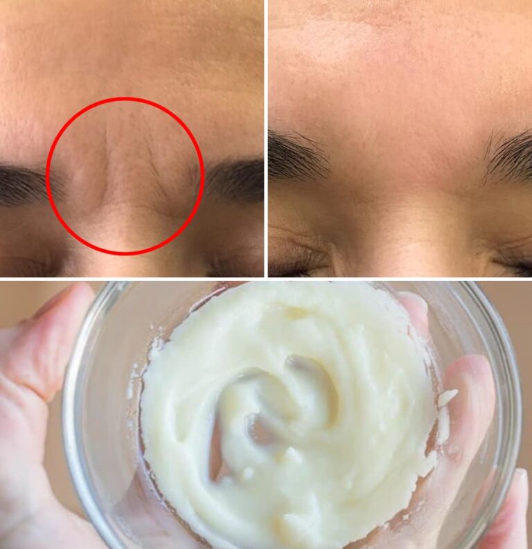 2 maschere anti-rughe per una fronte liscia e giovane