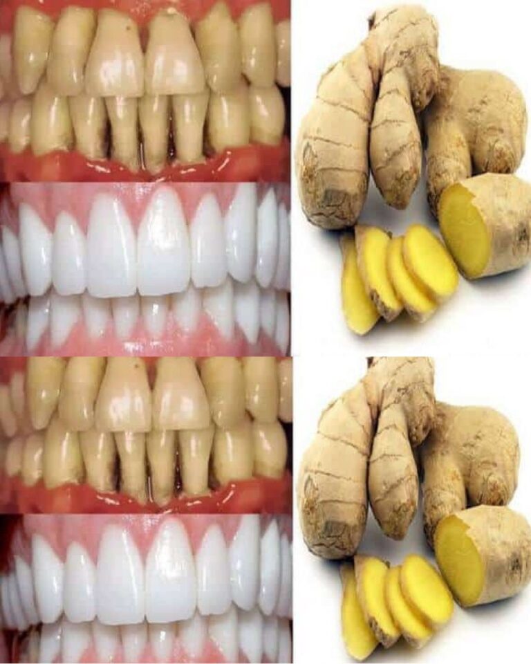 Prepara questo rimedio con zenzero e sale per sbiancare i denti