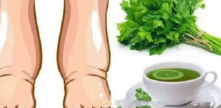 Questo potente tè fatto in casa cura le gambe gonfie in pochi giorni
