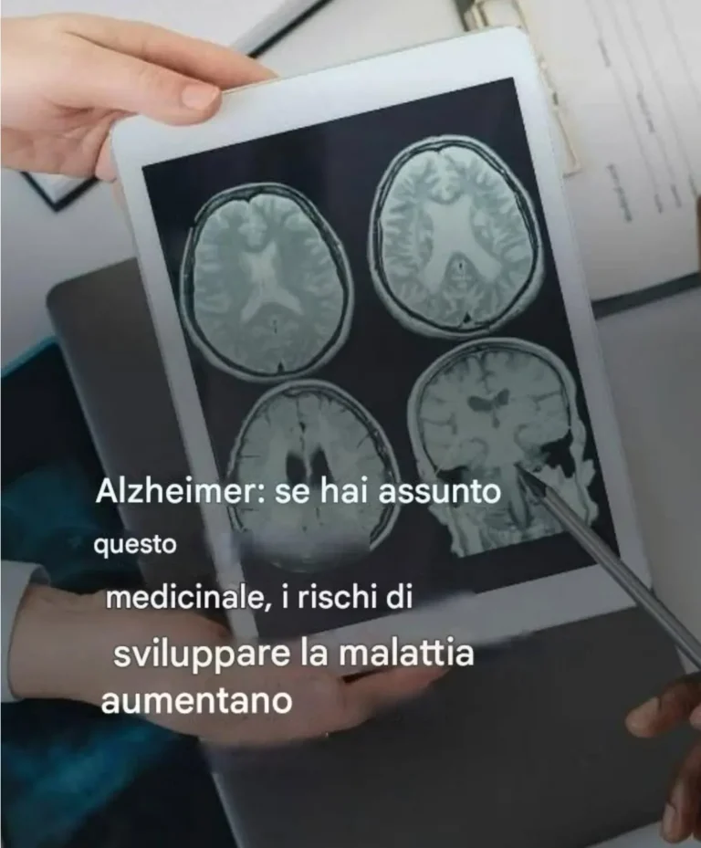Alzheimer: queste 6 abitudini che aumentano il rischio senza che tu te ne accorga