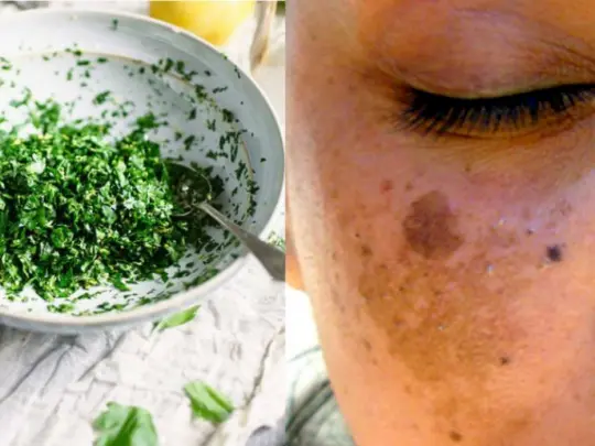 Prezzemolo: il segreto naturale che molte persone usano per una pelle più chiara e luminosa
