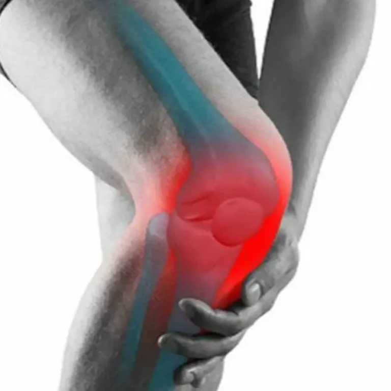 Ecco la vitamina che manca al tuo corpo quando ti fanno male gambe e ossa