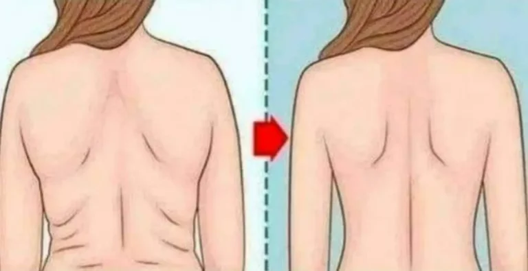 3 ricette con bicarbonato di sodio per bruciare il grasso addominale