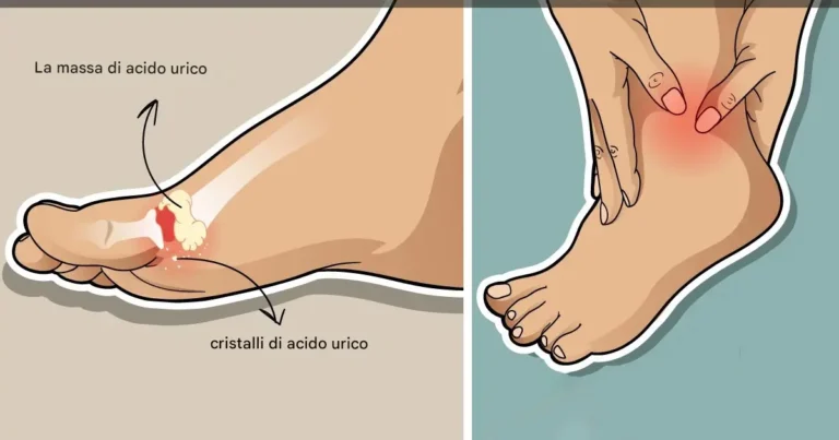 8 alimenti che possono abbassare i livelli di acido urico nell’organismo