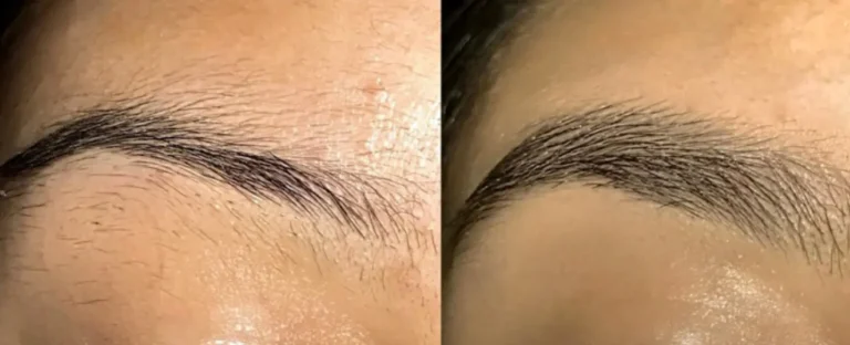 Come accelerare la crescita delle sopracciglia?