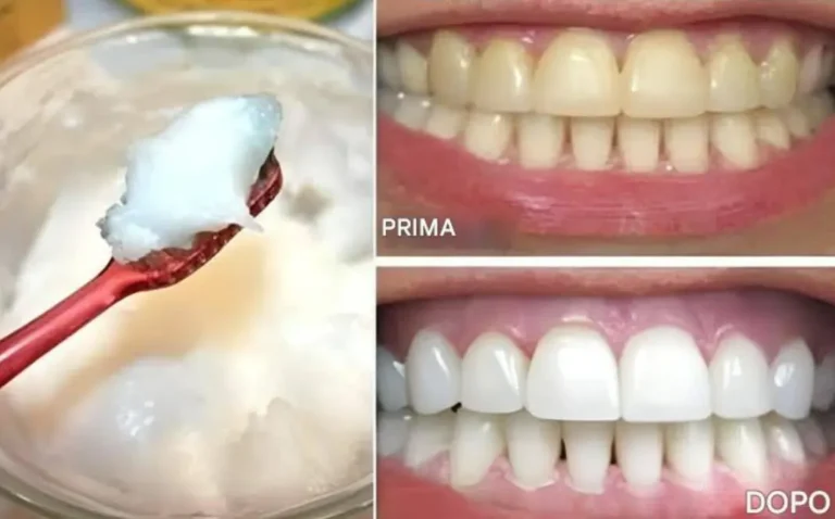 Sbianca i tuoi denti ed elimina l’alito cattivo, il tartaro e la placca con QUESTO UNICO ingrediente!