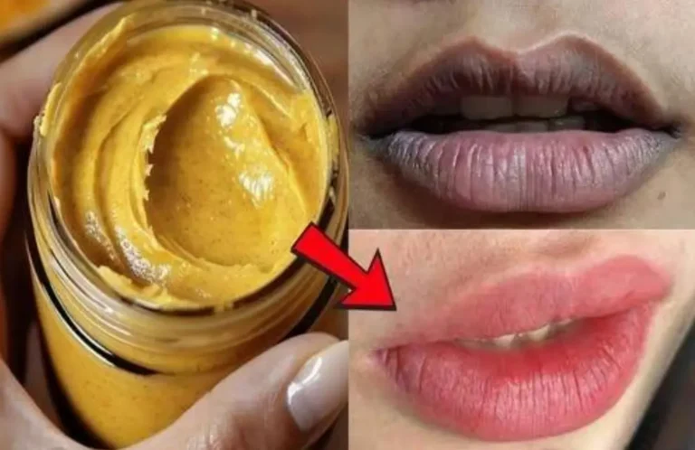 I migliori rimedi per sbarazzarsi delle labbra scure